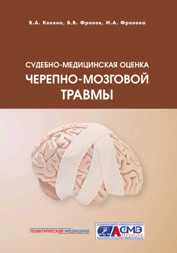 Судебно-медицинская оценка черепно-мозговой травмы