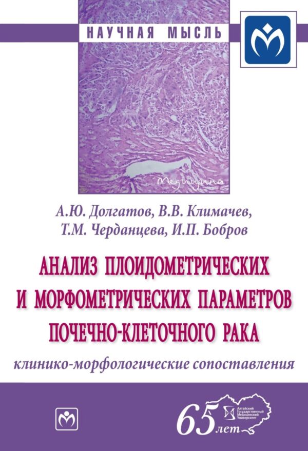 Анализ плоидометрических и морфометрических параметров почечно-клеточного рака: клинико-морфологические сопоставления