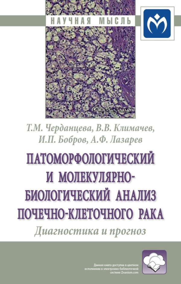 Патоморфологический и молекулярно-биологический анализ почечно-клеточного рака. Диагностика и прогноз